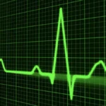heartbeat in networking