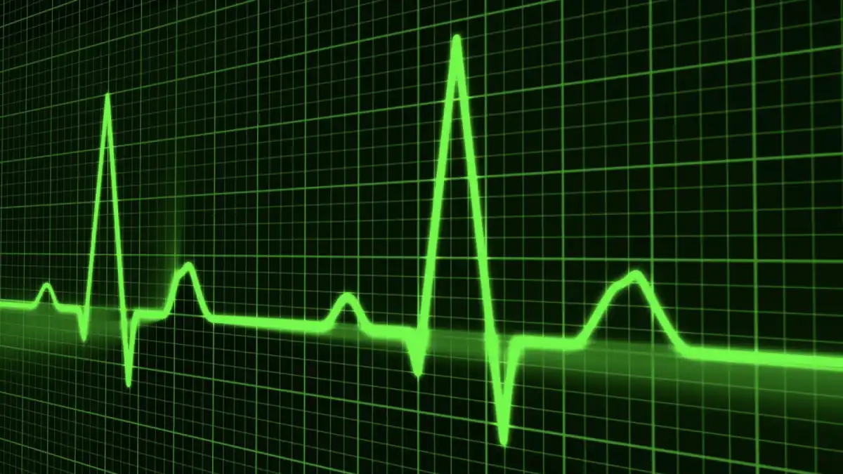 Heartbeat